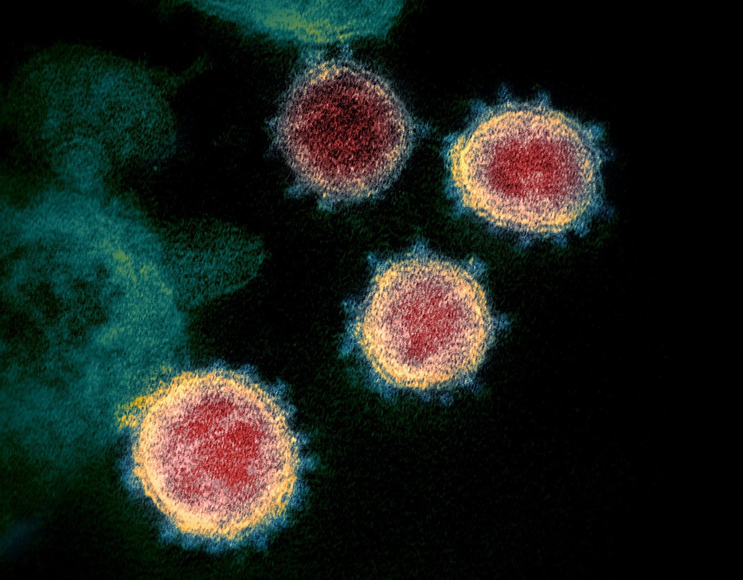 -novel_coronavirus_sars-cov-2